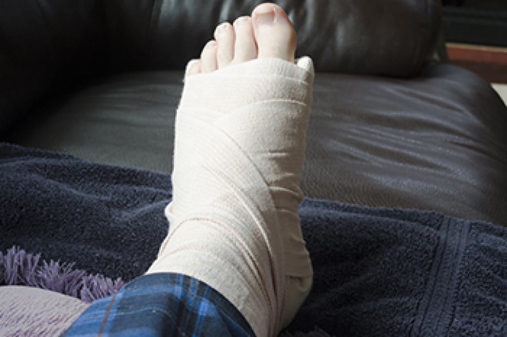 What You Should Know About Foot Fractures