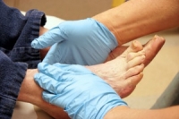 Effective Methods to Help Diabetic Patients' Feet Feel Better